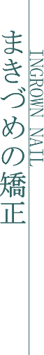 まきづめの矯正