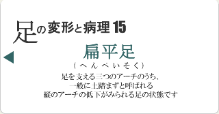 扁平足