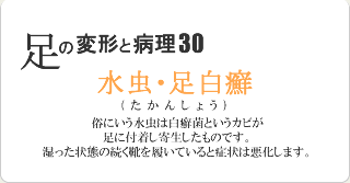水虫(足白癬)