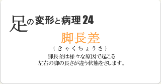 脚長差 足の変形と病理 横浜のオーダー健康靴プロフィットイイジマ