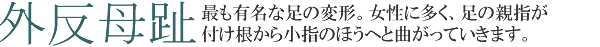外反母趾