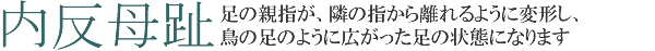 内反母趾